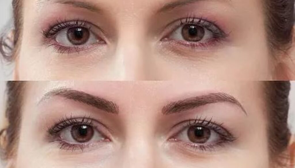 Microblading Your Eyebrows What You Need to Know