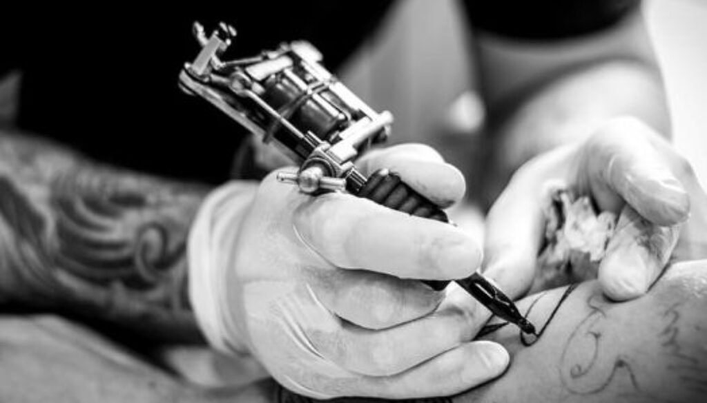 Tips to Get Prepared for Tattoo Removal Treatment Sessions