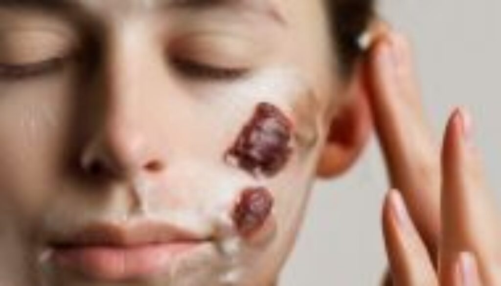 best moisturizer for eczema on face